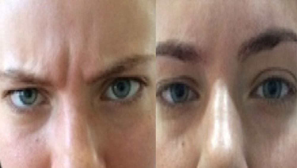 Anti wrinkle G B and A
